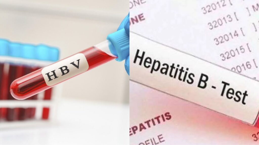HBV