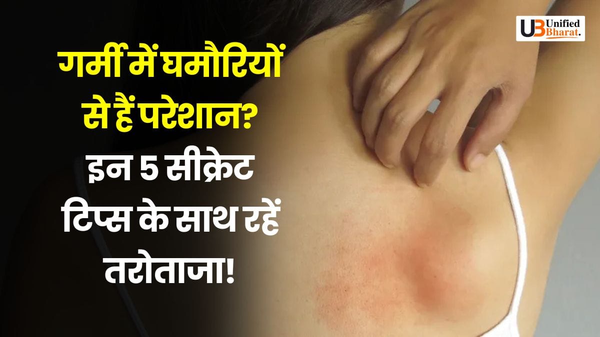 beat-summer-prickly-heat-best-tips