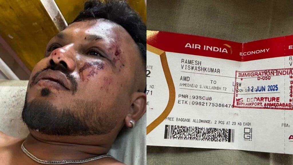 Ahmedabad Plane Crash - Viswas Kumar Ramesh