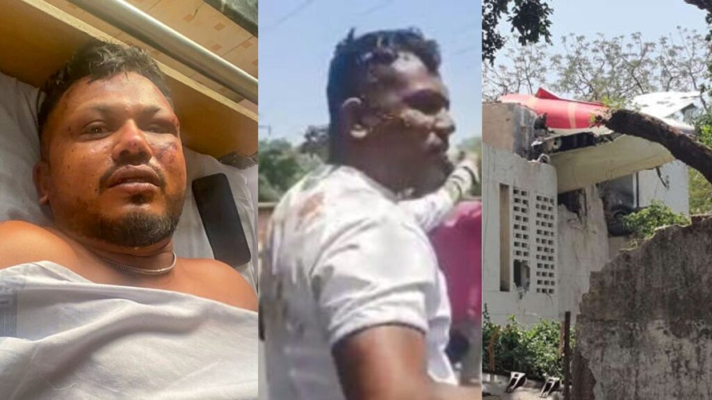 Ahmedabad Plane Crash - Viswas Kumar Ramesh